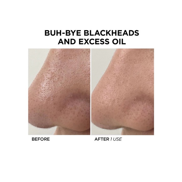 Beautybio Glofacial Hydro-Infusion Pore Cleansing Tool NIB💙 - Picture 7 of 13